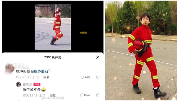 霍思燕评论区回复网友 称嗯哼不是腺样体面容