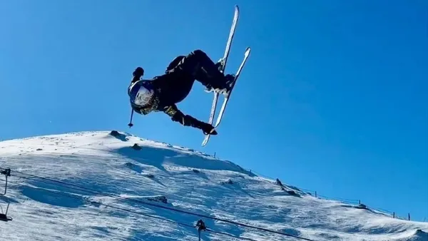 Gu Ailing was injured again and is undergoing medical imaging examination